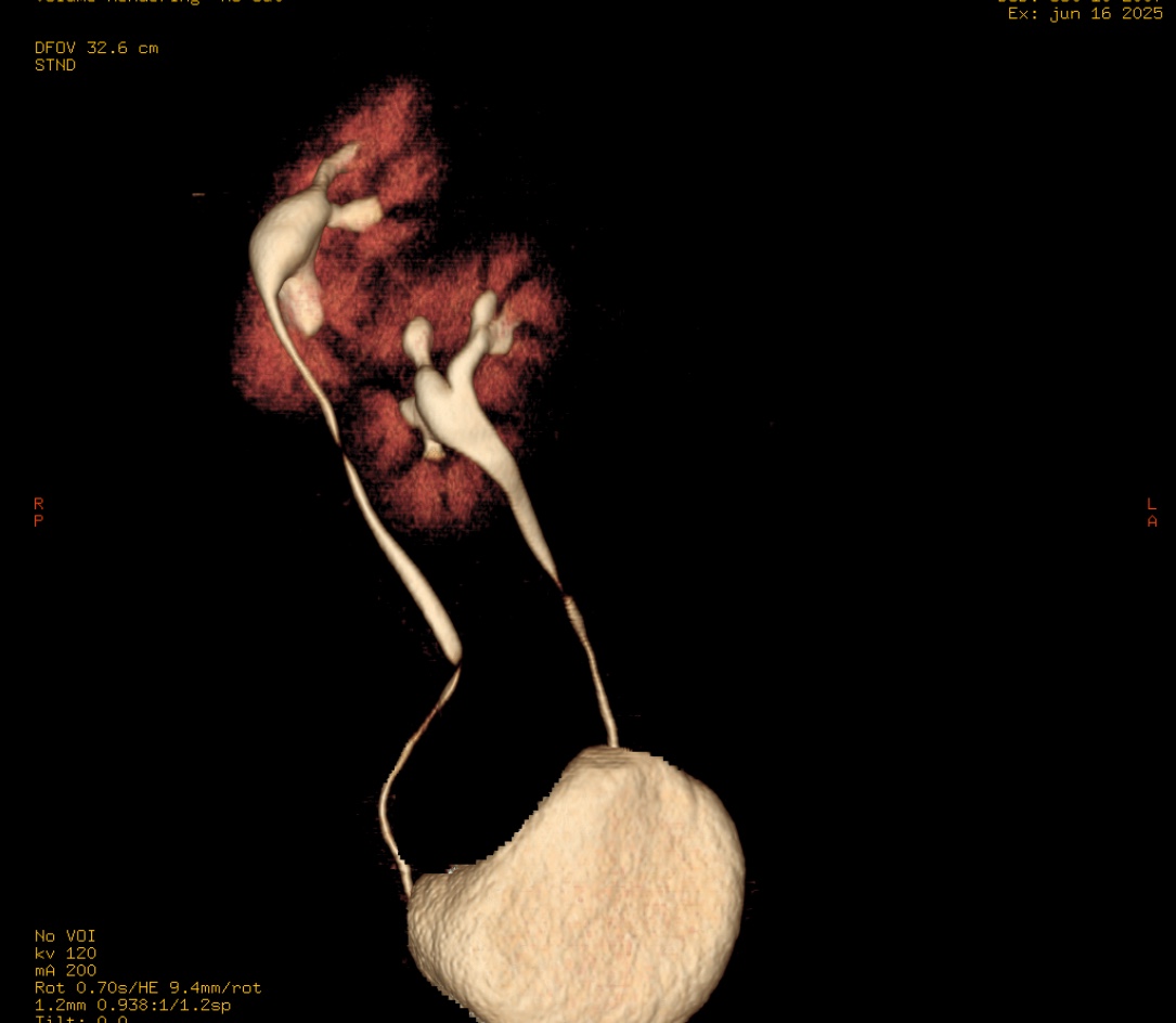 Reconstrucción 3D 1